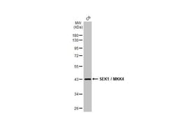 Invitrogen MAP2K4 Recombinant Rabbit Monoclonal Antibody (HL1888) 100 &mu;L;