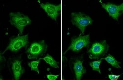 Invitrogen WNT4 Recombinant Rabbit Monoclonal Antibody (HL1889) 100 &mu;L;