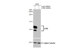 Invitrogen Ly-6E Recombinant Rabbit Monoclonal Antibody (HL1933) 100 &mu;L | Buy Online | Invitrogen&trade; | Fisher Scientific