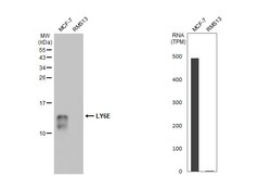 Invitrogen Ly-6E Recombinant Rabbit Monoclonal Antibody (HL1933) 100 &mu;L | Buy Online | Invitrogen&trade; | Fisher Scientific