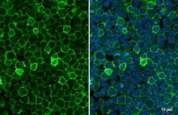 FCGR2B Recombinant Rabbit Monoclonal Antibody (HL1950), Invitrogen 100