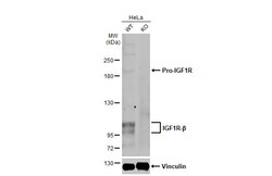 Invitrogen IGF1R (CD221) Recombinant Rabbit Monoclonal Antibody (HL1957)