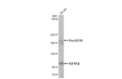 Invitrogen IGF1R (CD221) Recombinant Rabbit Monoclonal Antibody (HL1957)