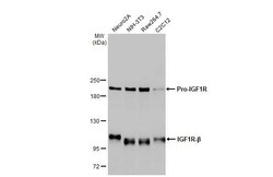 Invitrogen IGF1R (CD221) Recombinant Rabbit Monoclonal Antibody (HL1957)