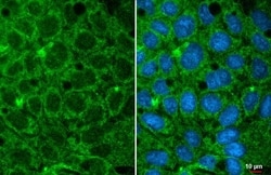 Invitrogen GPD1 Recombinant Rabbit Monoclonal Antibody (HL1959) 100 &mu;L;