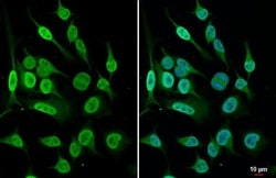 Invitrogen Histone H4 Recombinant Rabbit Monoclonal Antibody (HL1977) 100