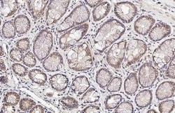 Invitrogen SIGIRR Recombinant Rabbit Monoclonal Antibody (HL2008) 100 &mu;L;