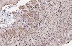 Invitrogen CDK6 Recombinant Rabbit Monoclonal Antibody (HL2078) 100 &mu;L;