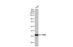 Invitrogen CDK6 Recombinant Rabbit Monoclonal Antibody (HL2078) 100 &mu;L;