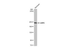 Invitrogen LRP4 Recombinant Rabbit Monoclonal Antibody (HL2080) 100 &mu;L;