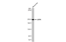 Invitrogen LRP4 Recombinant Rabbit Monoclonal Antibody (HL2080) 100 &mu;L;