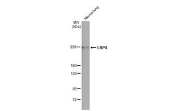 Invitrogen LRP4 Recombinant Rabbit Monoclonal Antibody (HL2080) 100 &mu;L;