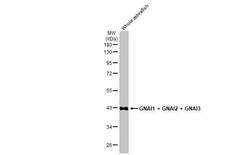 Invitrogen GNAI1/GNAI2/GNAI3 Recombinant Rabbit Monoclonal Antibody (HL2092) 100 &mu;L | Buy Online | Invitrogen&trade; | Fisher Scientific