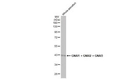 Invitrogen GNAI1/GNAI2/GNAI3 Recombinant Rabbit Monoclonal Antibody (HL2093)