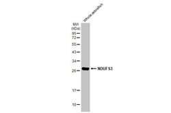 Invitrogen NDUFS3 Recombinant Rabbit Monoclonal Antibody (HL2097) 100 &mu;L | Buy Online | Invitrogen&trade; | Fisher Scientific