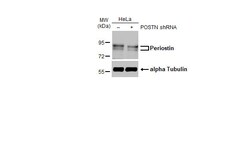 Invitrogen Periostin Recombinant Rabbit Monoclonal Antibody (HL2112) 100 &mu;L | Buy Online | Invitrogen&trade; | Fisher Scientific