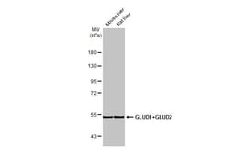 GluD1/GluD2 Recombinant Rabbit Monoclonal Antibody (HL2124), Invitrogen