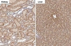 Invitrogen GluD1/GluD2 Recombinant Rabbit Monoclonal Antibody (HL2125)