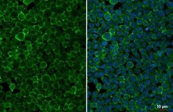 Invitrogen Pepsinogen I Recombinant Rabbit Monoclonal Antibody (HL2137)