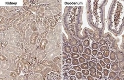 Invitrogen Annexin A1 Recombinant Rabbit Monoclonal Antibody (HL2141) 100