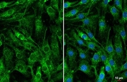 Invitrogen CYR61 Recombinant Rabbit Monoclonal Antibody (HL2144) 100 &mu;L;