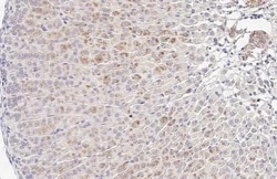 Invitrogen LGALS3BP Recombinant Rabbit Monoclonal Antibody (HL2168) 100 &mu;L | Buy Online | Invitrogen&trade; | Fisher Scientific