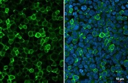 Invitrogen&trade;&nbsp;IBA1 Recombinant Mouse Monoclonal Antibody (HL1880-MS)