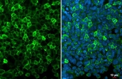 Invitrogen™ IBA1 Recombinant Rat Monoclonal Antibody (HL1880-RT)