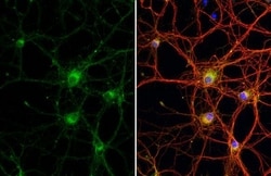 Invitrogen WNK1 Recombinant Rabbit Monoclonal Antibody (HL2184) 100 &mu;L;