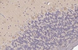 Invitrogen WNK1 Recombinant Rabbit Monoclonal Antibody (HL2184) 100 &mu;L;