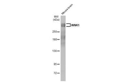 Invitrogen WNK1 Recombinant Rabbit Monoclonal Antibody (HL2184) 100 &mu;L;