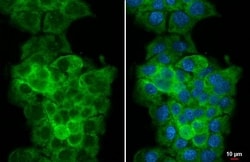 Invitrogen WARS Recombinant Rabbit Monoclonal Antibody (HL2186) 100 &mu;L | Buy Online | Invitrogen&trade; | Fisher Scientific