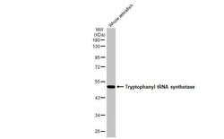 Invitrogen WARS Recombinant Rabbit Monoclonal Antibody (HL2186) 100 &mu;L | Buy Online | Invitrogen&trade; | Fisher Scientific