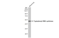 Invitrogen WARS Recombinant Rabbit Monoclonal Antibody (HL2186) 100 &mu;L | Buy Online | Invitrogen&trade; | Fisher Scientific