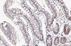 Invitrogen CXCR7 Recombinant Rabbit Monoclonal Antibody (HL2189) 100 &mu;L;