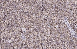 Invitrogen CXCR7 Recombinant Rabbit Monoclonal Antibody (HL2189) 100 &mu;L;
