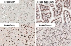 Invitrogen CBP Recombinant Rabbit Monoclonal Antibody (HL2197) 100 &mu;L;