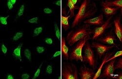 Invitrogen HES1 Recombinant Rabbit Monoclonal Antibody (HL2198) 100 &mu;L | Buy Online | Invitrogen&trade; | Fisher Scientific