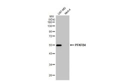 Invitrogen PFKFB4 Recombinant Rabbit Monoclonal Antibody (HL2204) 100 &mu;L;