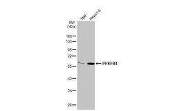 Invitrogen PFKFB4 Recombinant Rabbit Monoclonal Antibody (HL2204) 100 &mu;L;