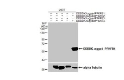 Invitrogen PFKFB4 Recombinant Rabbit Monoclonal Antibody (HL2204) 100 &mu;L;