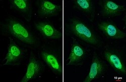Invitrogen ULK2 Recombinant Rabbit Monoclonal Antibody (HL2206) 100 &mu;L;