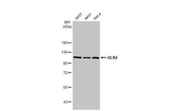 Invitrogen ULK2 Recombinant Rabbit Monoclonal Antibody (HL2206) 100 &mu;L;