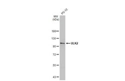 Invitrogen ULK2 Recombinant Rabbit Monoclonal Antibody (HL2206) 100 &mu;L;