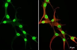 Invitrogen RUNX1 Recombinant Rabbit Monoclonal Antibody (HL2211) 100 &mu;L;