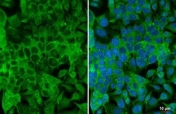 Invitrogen Angiogenin Recombinant Rabbit Monoclonal Antibody (HL2215) 100