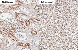 Invitrogen Angiogenin Recombinant Rabbit Monoclonal Antibody (HL2215) 100