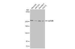 Invitrogen mTOR Recombinant Rabbit Monoclonal Antibody (HL2217) 100 &mu;L | Buy Online | Invitrogen&trade; | Fisher Scientific