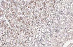 Invitrogen SERPINB2 Recombinant Rabbit Monoclonal Antibody (HL2218) 100