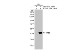 Invitrogen SERPINB2 Recombinant Rabbit Monoclonal Antibody (HL2218) 100